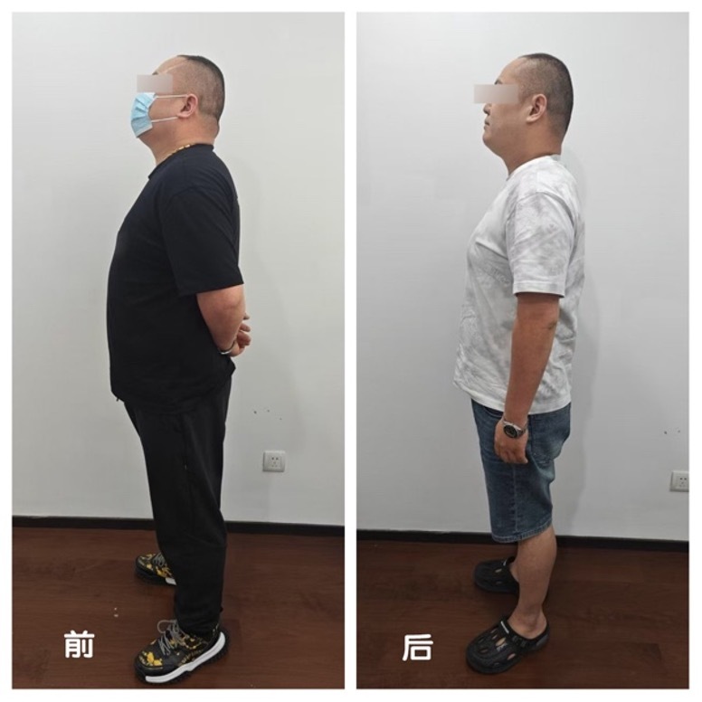 Kzooh, 第十人民医